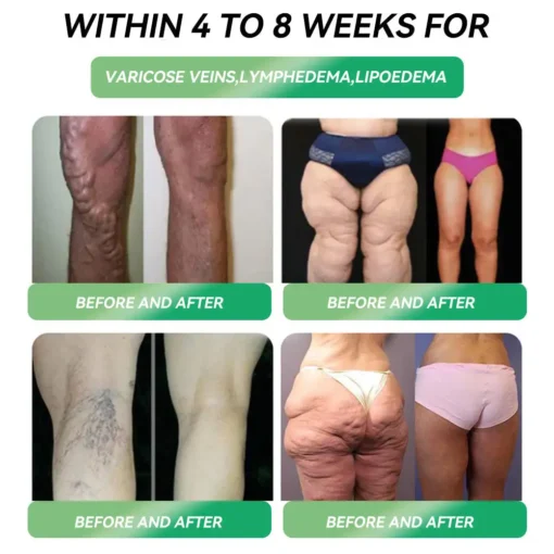Cyeraolmde™ GLP-1 Weight Loss Oral Solution