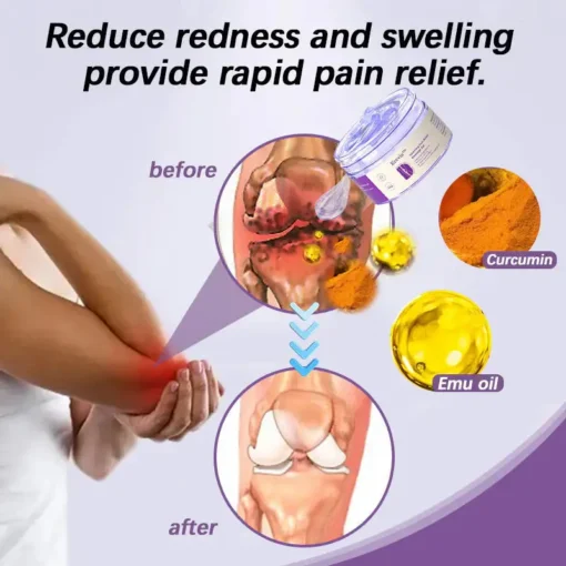 Krevia™Turmeric & Emu Oil Arthritis Soothing Pain Relief Massage Gel for Stiff Joints & Aches