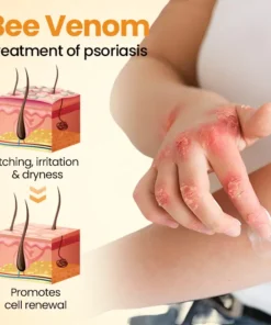Medazy® BeeLieve Psoriasis Skin Care