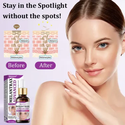 Newyuo® MelantraX Advanced Anti-Hyperpigmentation Essence