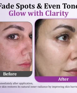 Newyuo® MelantraX Advanced Anti-Hyperpigmentation Essence