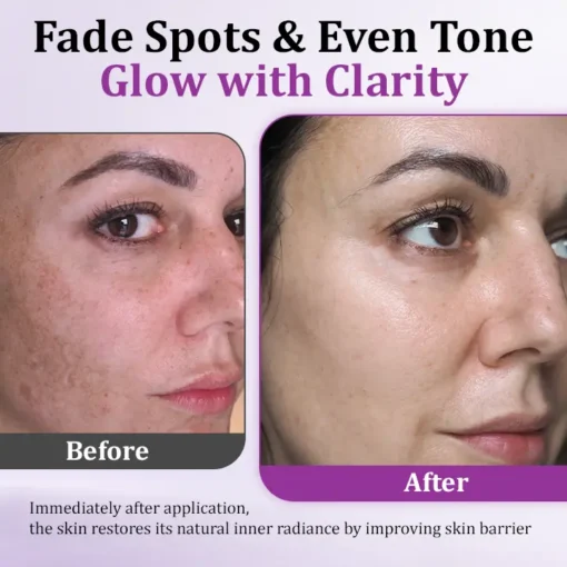 Newyuo® MelantraX Advanced Anti-Hyperpigmentation Essence