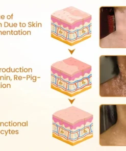 Newyuo® VitiCalm Bee Venom Cream