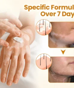 Newyuo® VitiCalm Bee Venom Cream