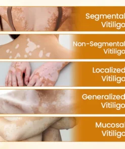 Newyuo® VitiCalm Bee Venom Cream