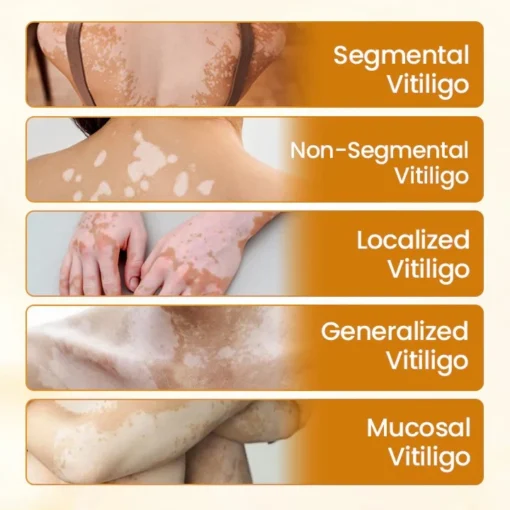Newyuo® VitiCalm Bee Venom Cream