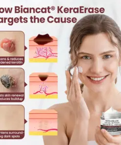 Rekulo® KeraErase Dual-Action Renewal Cream