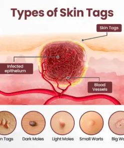 Rekulo® KeraErase Dual-Action Renewal Cream