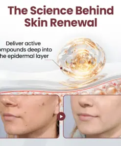 Rekulo® KeraErase Dual-Action Renewal Cream